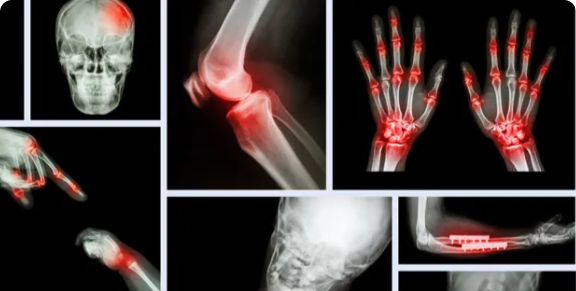 Classification des objets médicaux