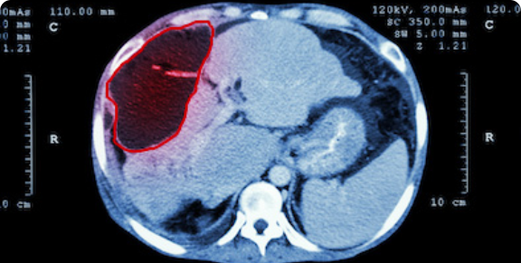 Détection des objets médicaux