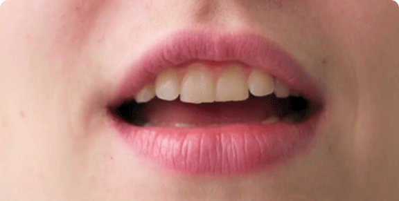 Lecture sur les lèvres