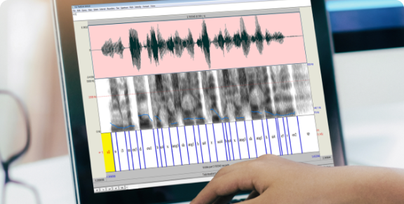 Segmentation phonémique